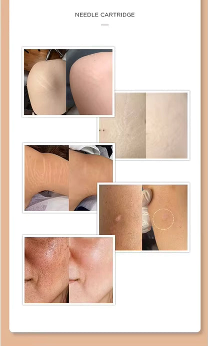 Permanent Makeup Ink Stretch Mark Camouflage Pigments Skin Tone Scar Camouflage Tattoo Ink for Restore Skin Tone Tattoo Ink